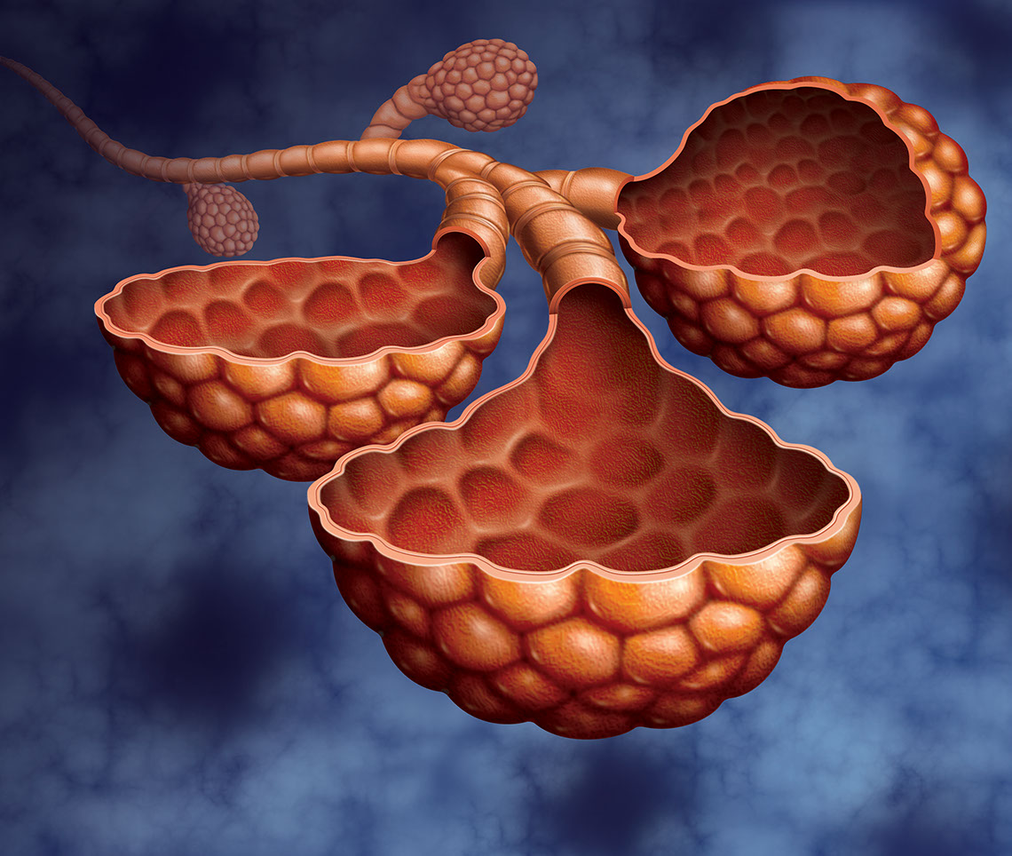 Medical-Educational-illustration-Medical_Alveoli Cutaway-Bill-Graham