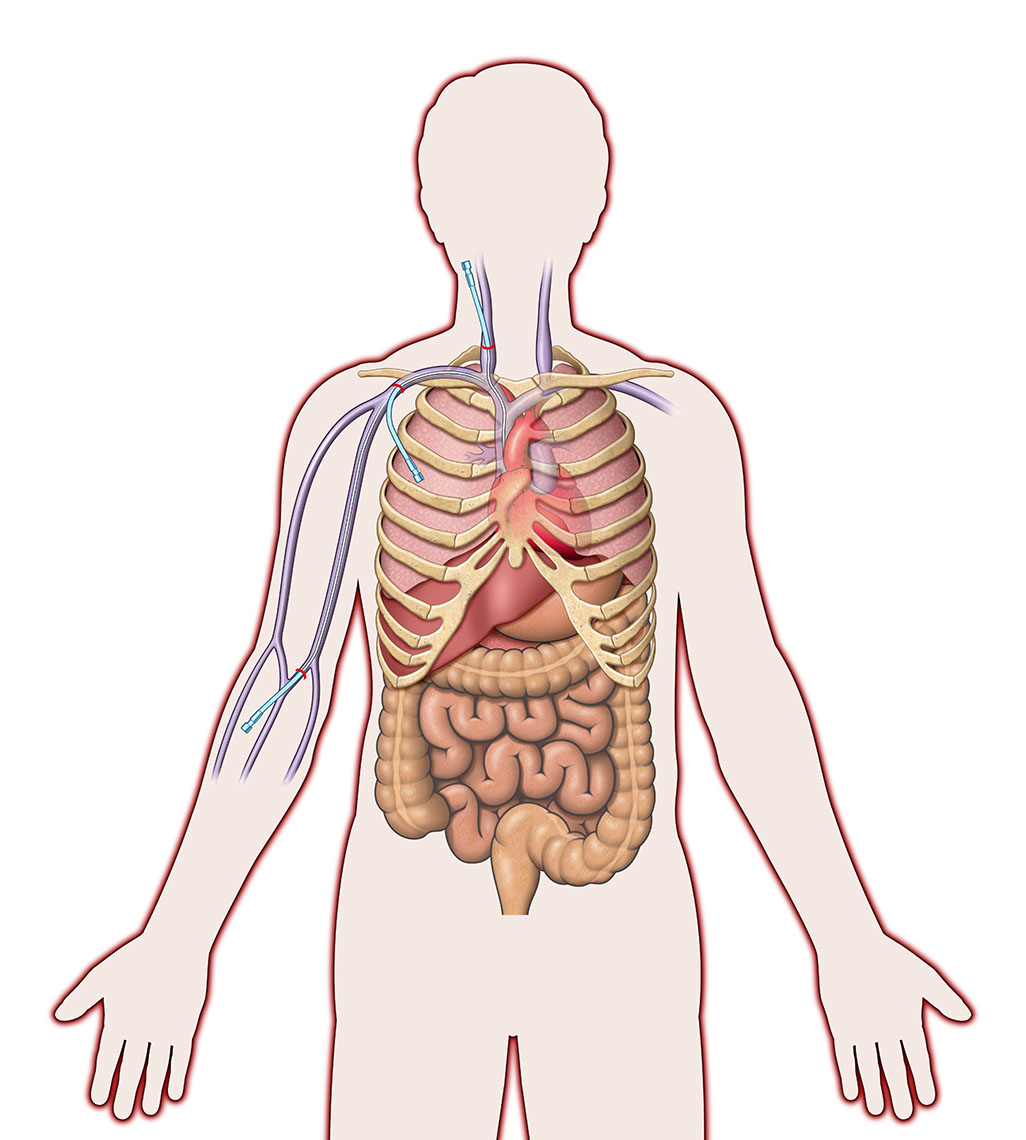 Medical-Educational-illustration-Medical_Intestines-Bill-Graham