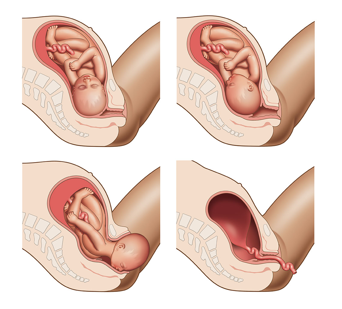 Fetus in Uterus & Birth Canal Stages of Birth